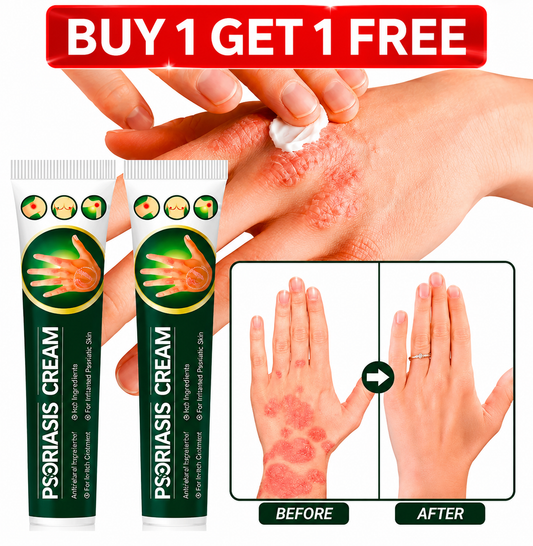 Psoriasis Cream - Herbal Skin Care Formula